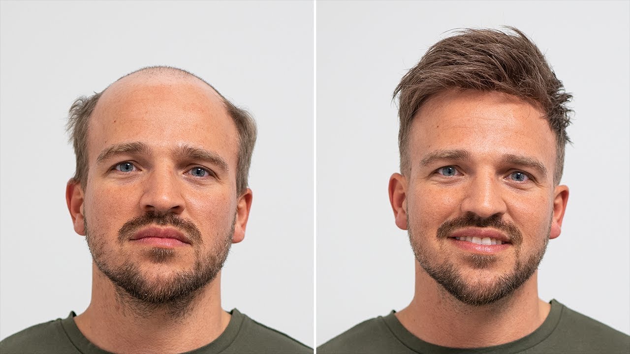 Perfectly Polished: Enhance Your Look with a Men’s Hair System