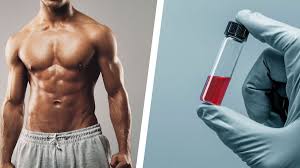 Exploring Your Options: Where to Buy Testosterone in the UK
