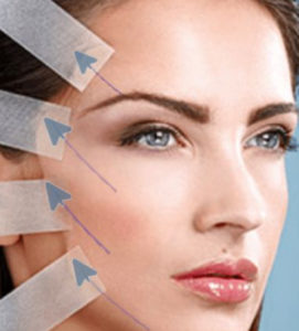 The Timeless Elegance of Fadenlifting in Zurich: SW Beautybar’s Artful Approach to Facial Rejuvenation